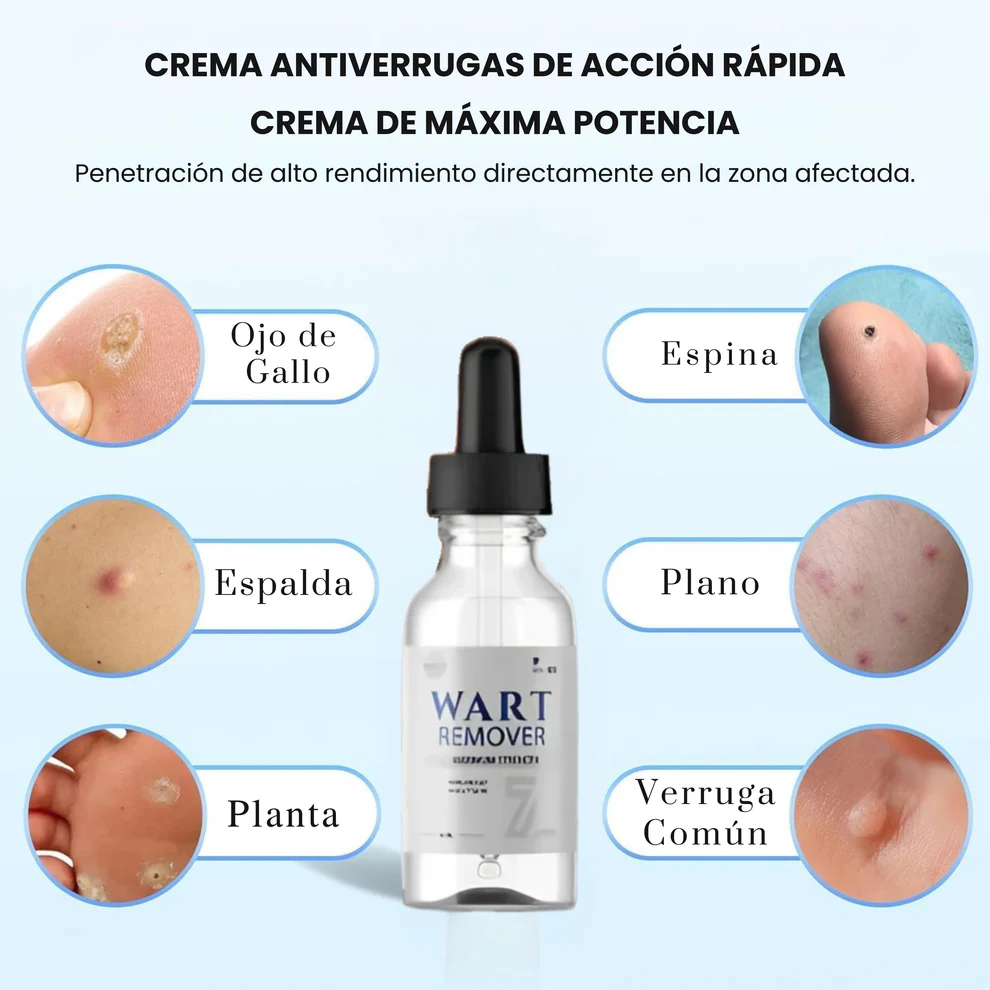 Wart Removedor™ - Removedor de Verrugas